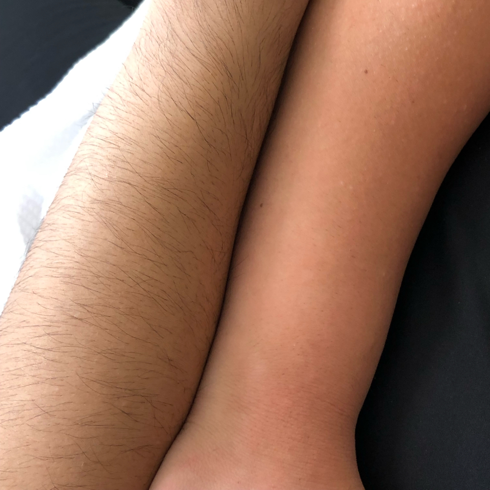 Full Arm Waxing