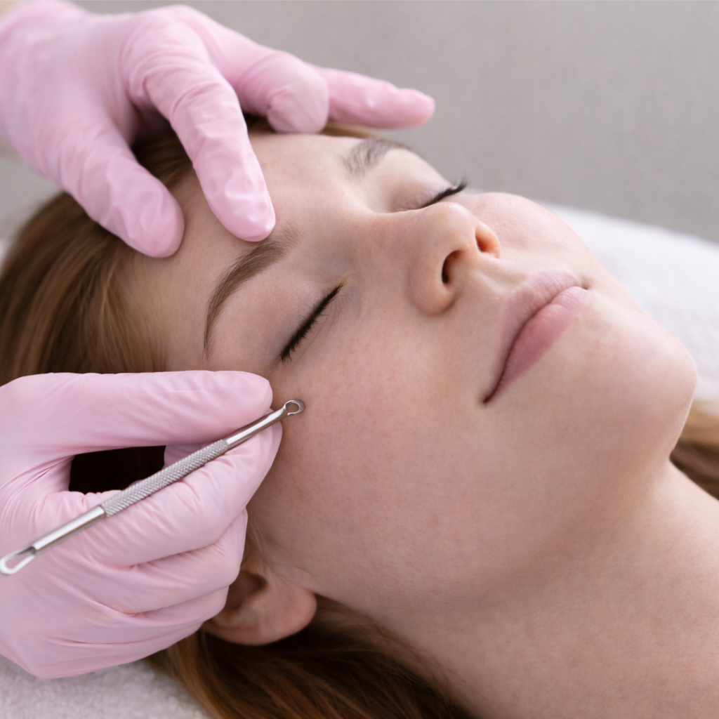 Extractions at The Face Studio in Overland Park, KS