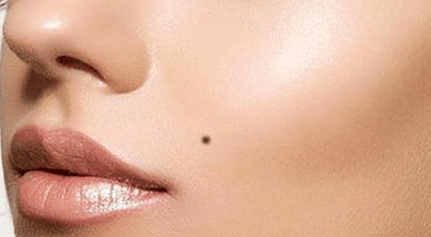 Beauty Mark