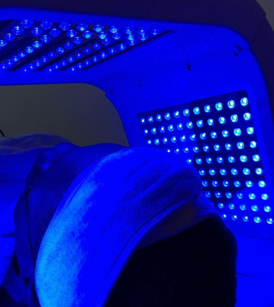 LED Light Therapy ADD ON