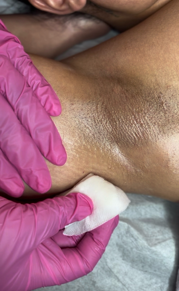 Under Arm Wax at Kandi Esthetics in Meriden, CT