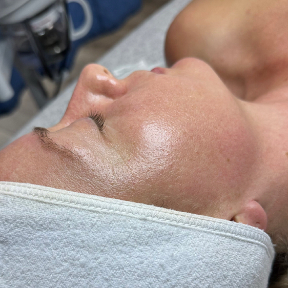 Dermaplaning at Prism Beauty in San Juan Capistrano, CA