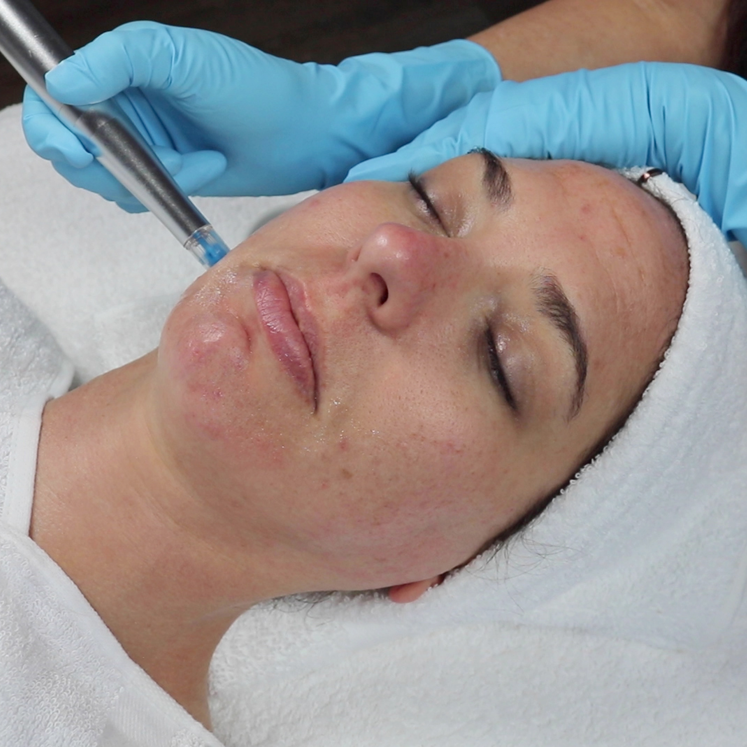 Nano Rezenerate Facial