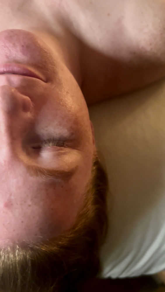 Sensitive Skin Facial