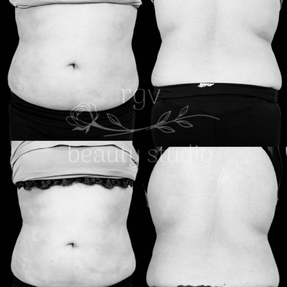 Sculpt + at RGV beauty studio in Edinburg, TX