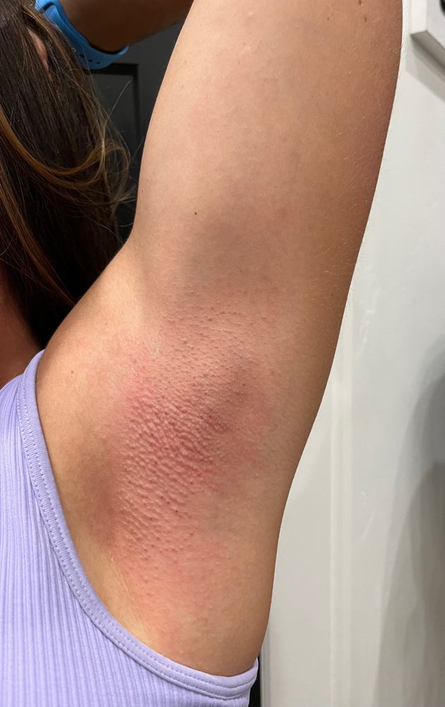 Underarm Wax