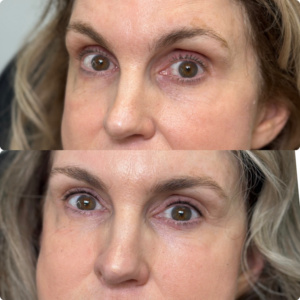 Upper Lash Enhancement at Katelyn Kosmetic in Boise, ID