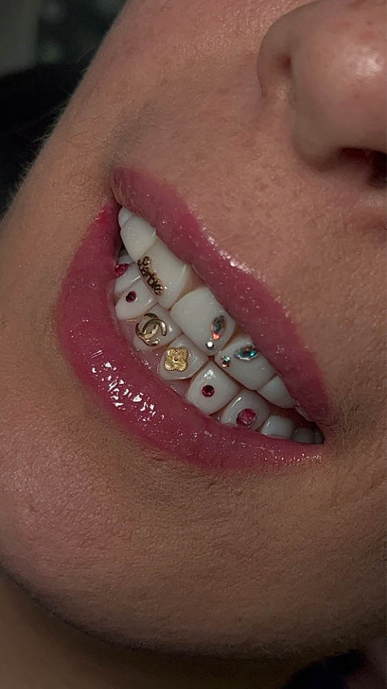 Teeth Whitening+Tooth Gem Training