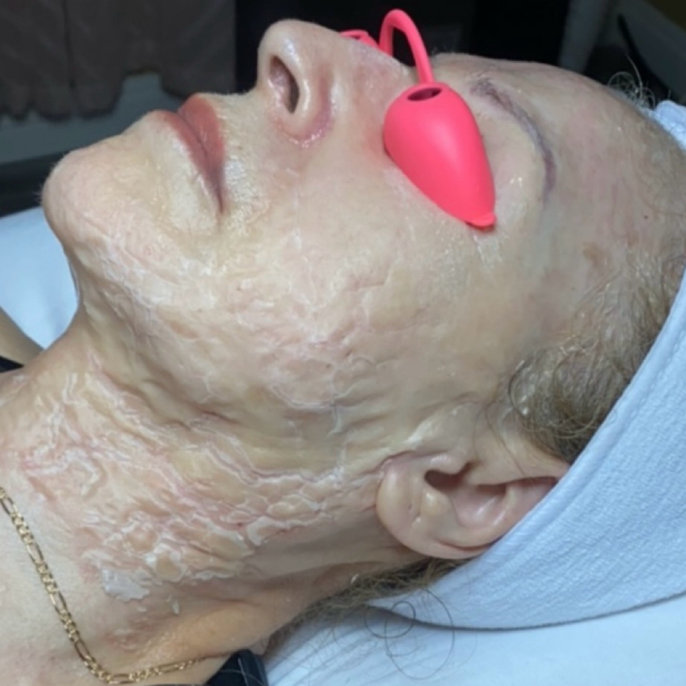 Age-Defy Renewal Facial at Diamond Beauty Studio in Rialto, CA