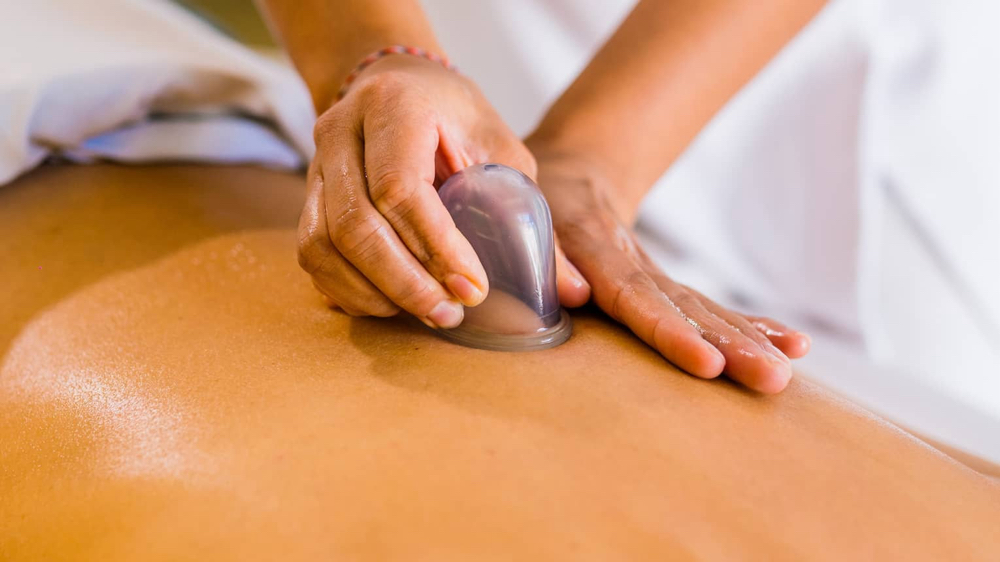 Cupping Therapy