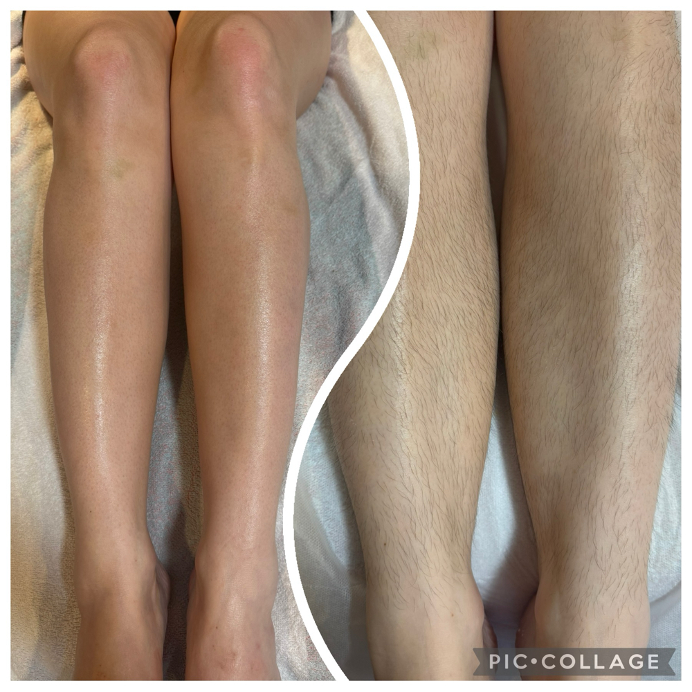 Full Leg Wax at Moonlight Aesthetics in pensacola, FL
