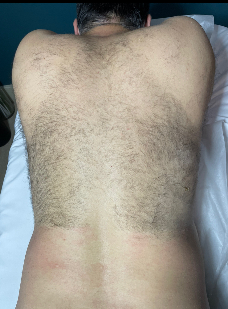 Mens Full Back Sugar Wax