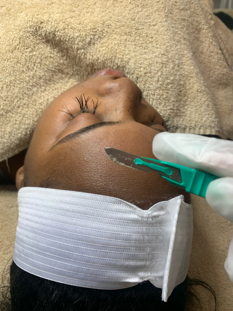 Dermaplaning (No Facial)