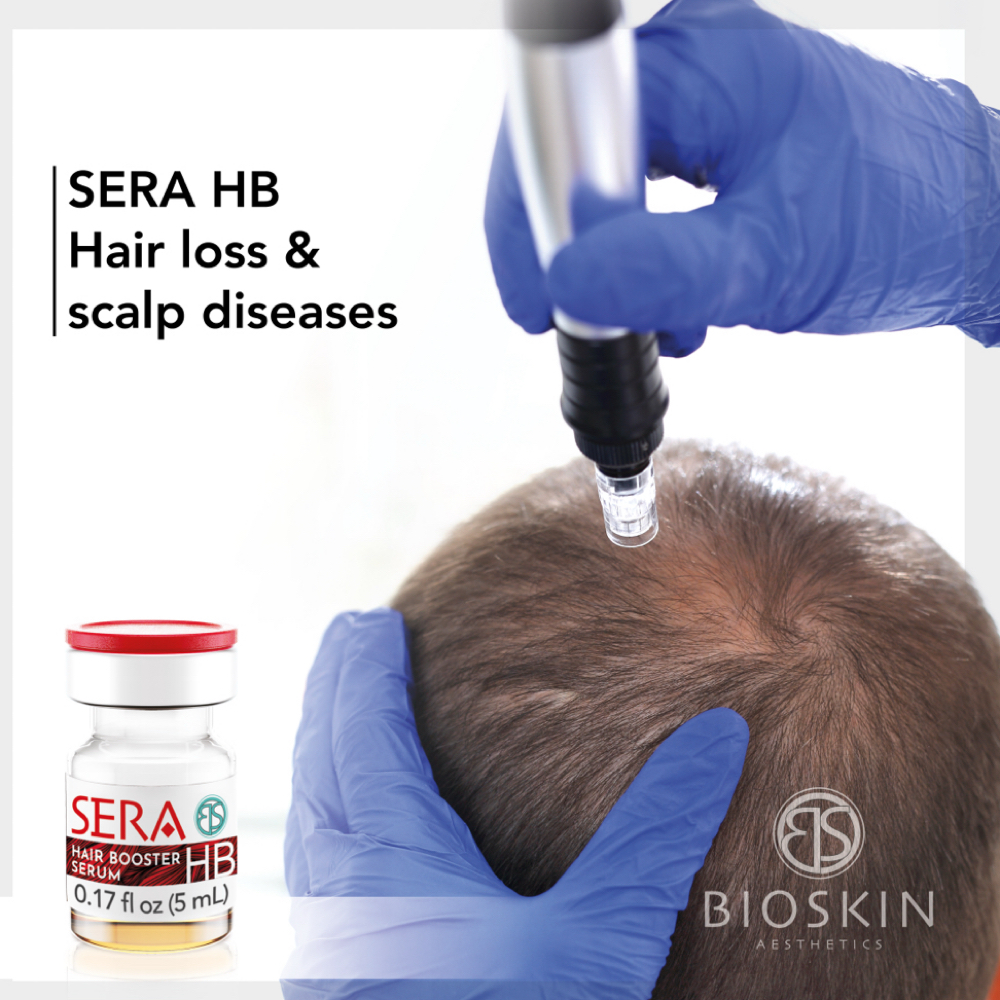 Scalp Restoration Therapy at KC Aesthetics Studio in Westport, CT
