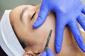 Dermaplaning Treatment Only