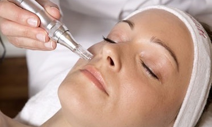 Nano-needling Product Infusion