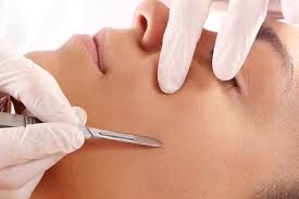 Dermaplaning