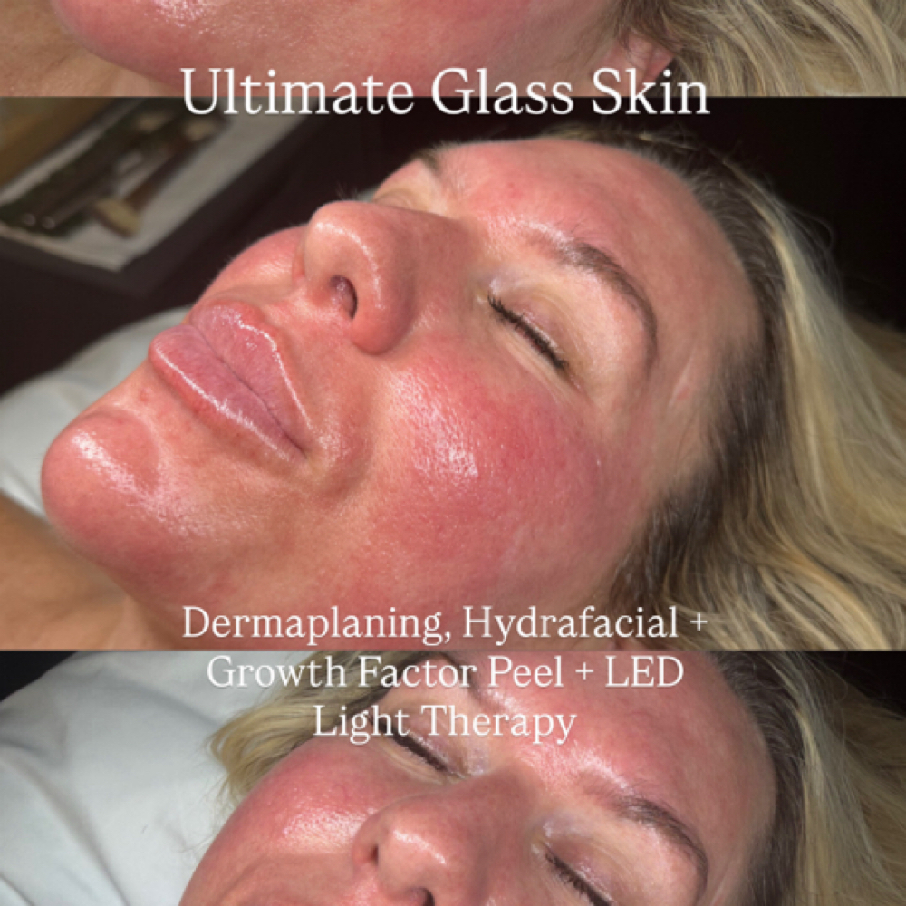 Ultimate Glass Skin Experience 💦 at Golden Hour Skin Studio in Sarasota, FL