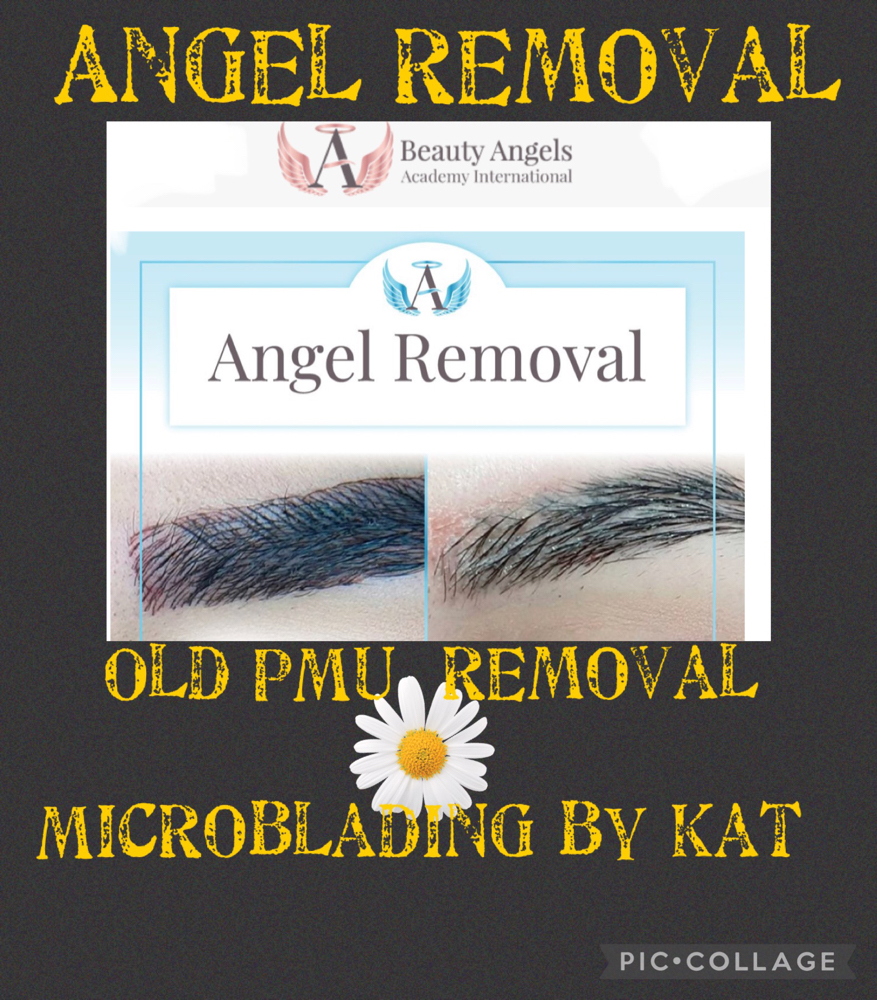 Tattoo Angel Removal