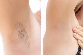 Underarm Wax