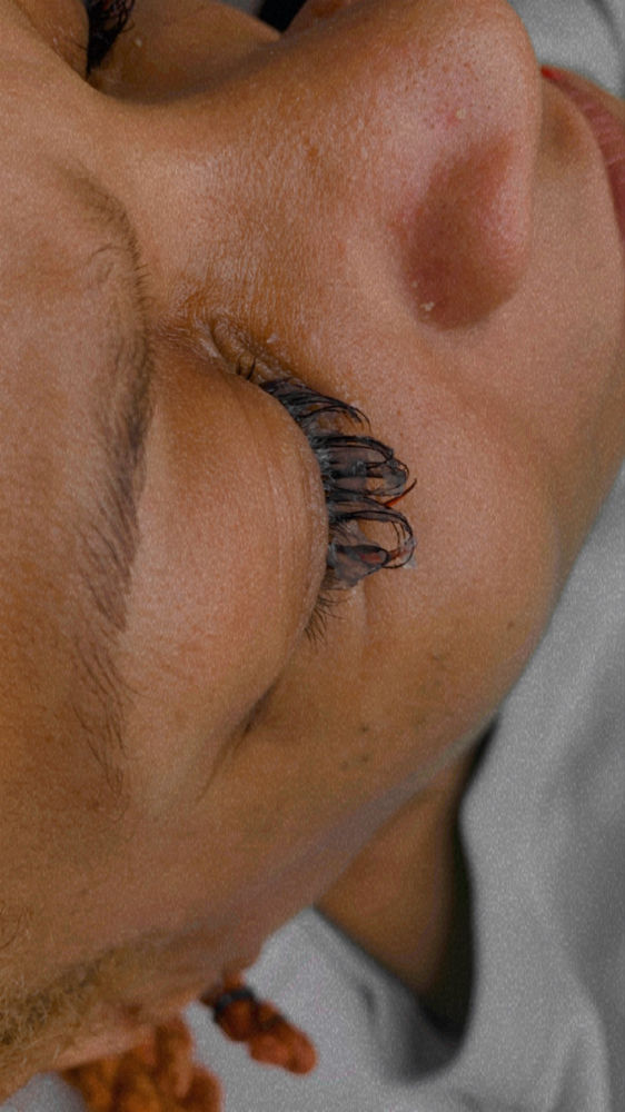 Lash Removal