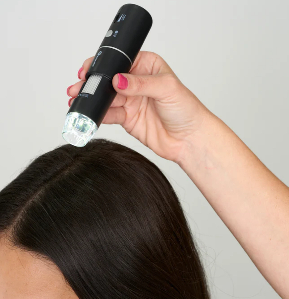 Scalp Treatment