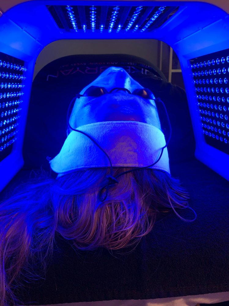 LED + Chemical Peel Treatment