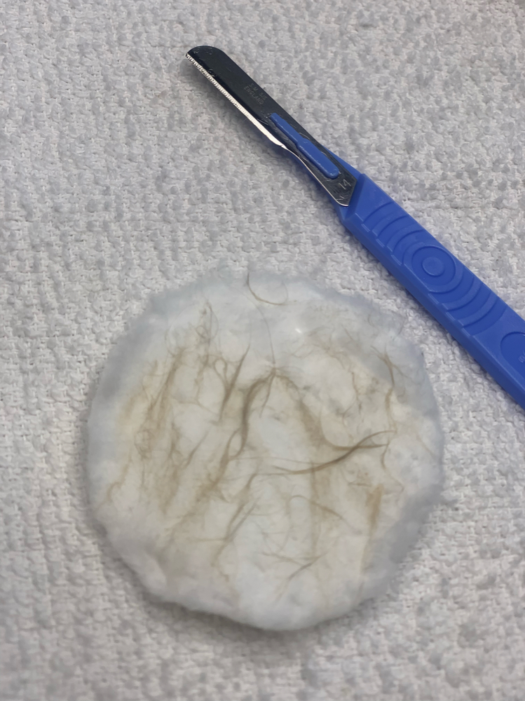 Add On- Dermaplane