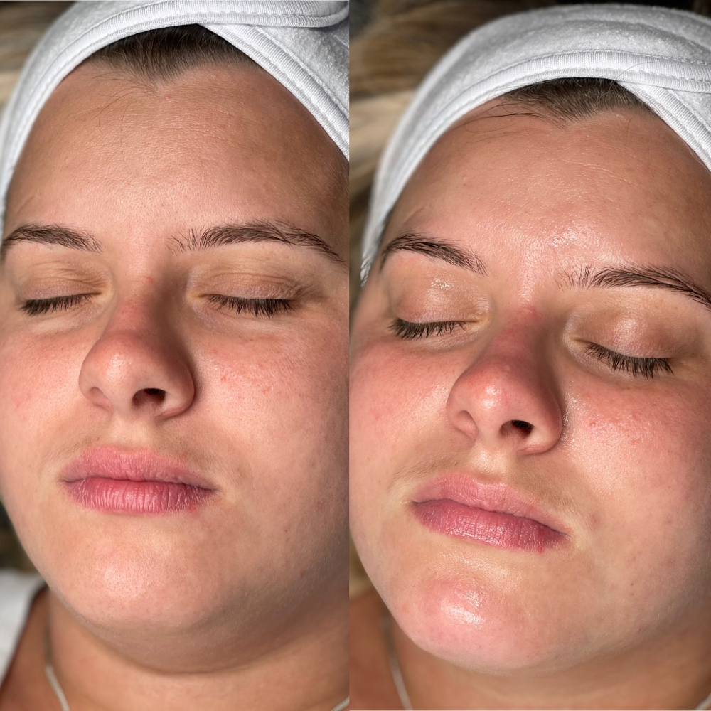 Express Facial