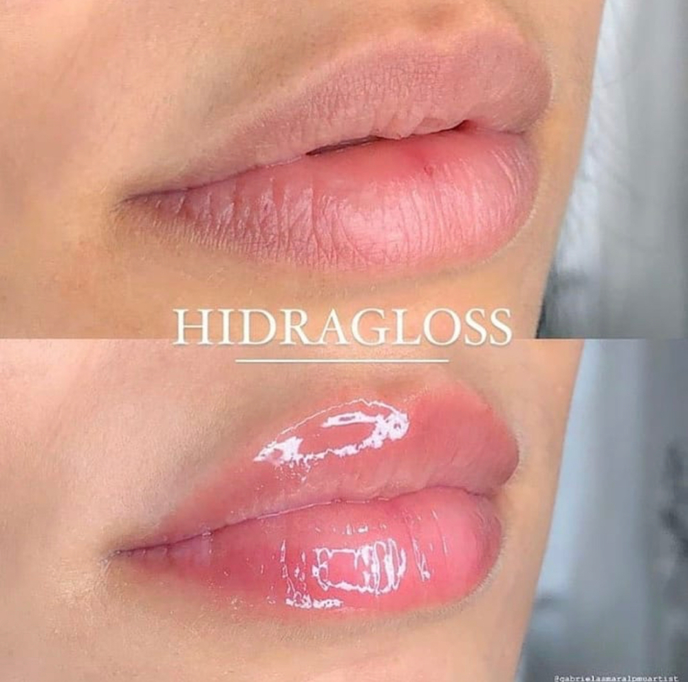 Hydra Lips Plumper Hyaluronic Acid