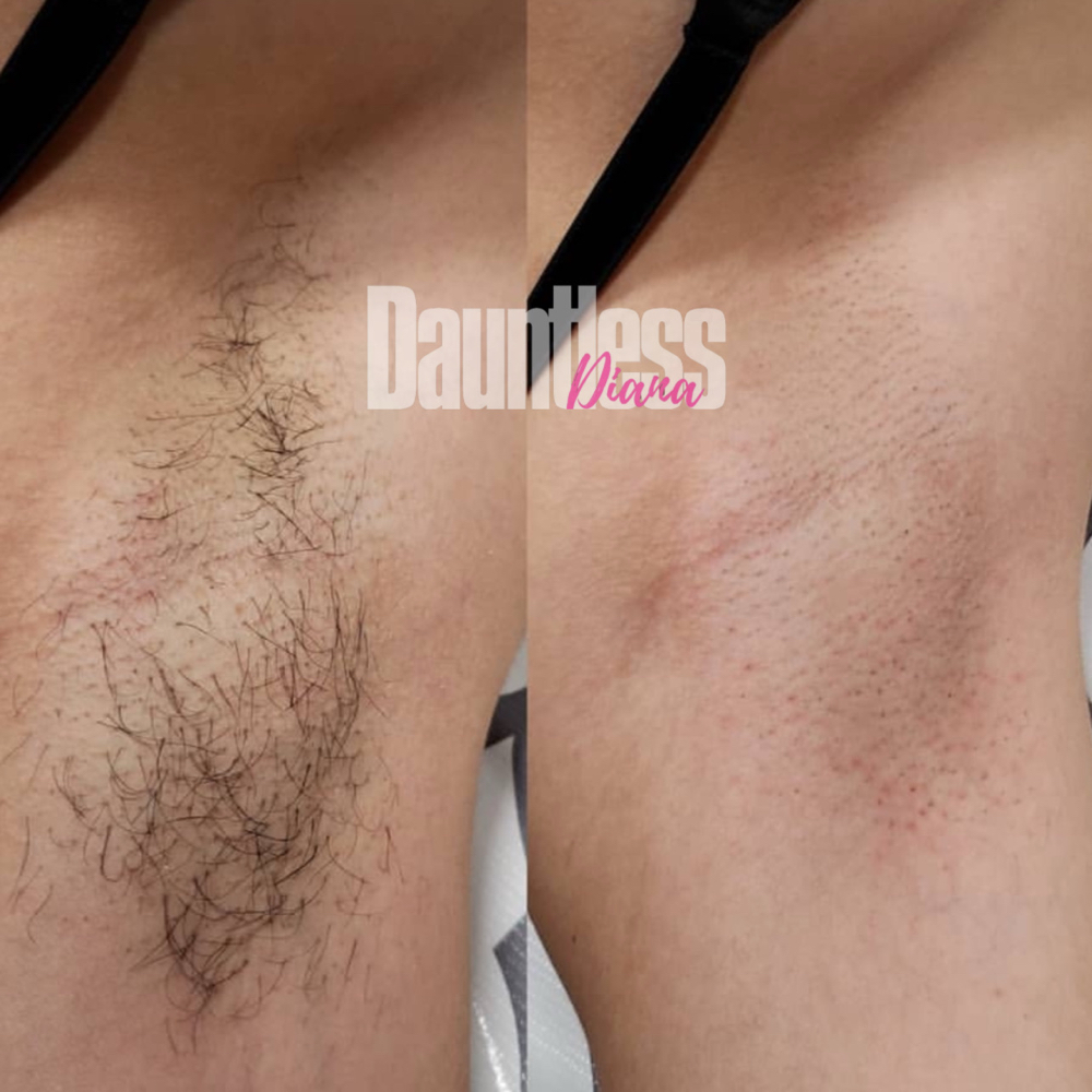 Underarm Wax