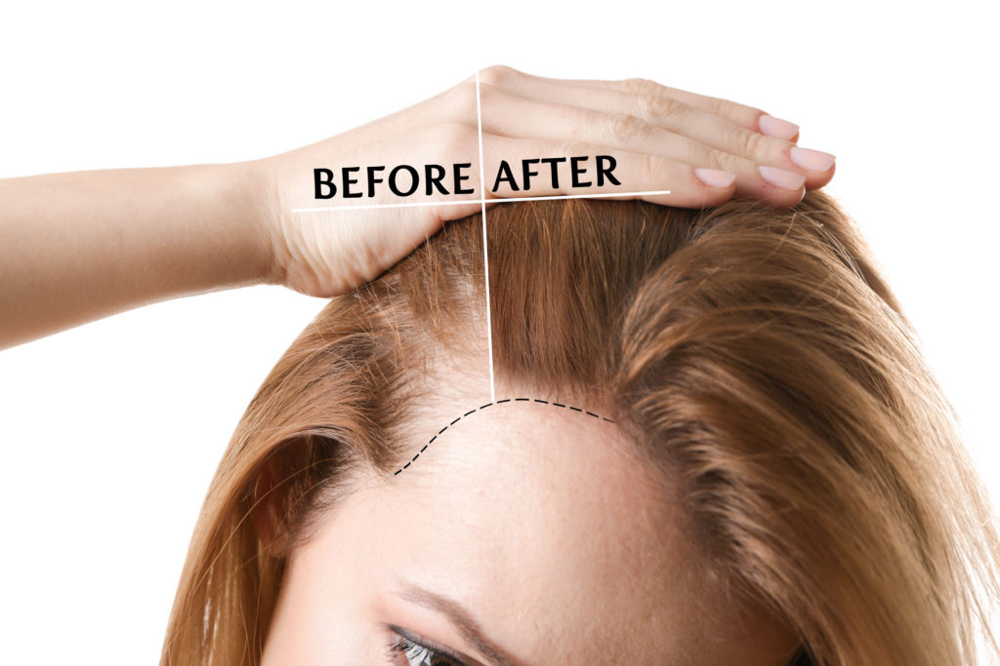 HydraFacial Scalp Powerwash
