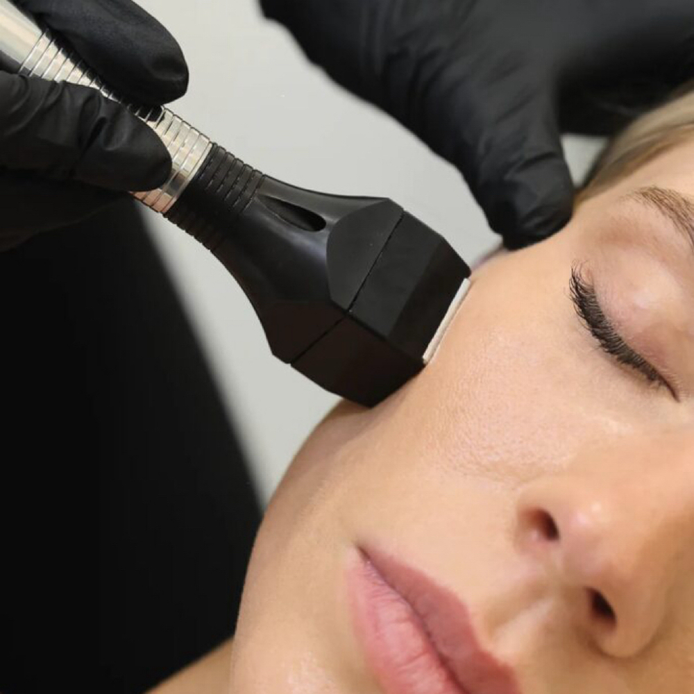 Forma Facial at Luxe Level Aesthetics in Darien, CT