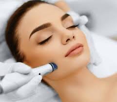 Diamond Microdermabrasion
