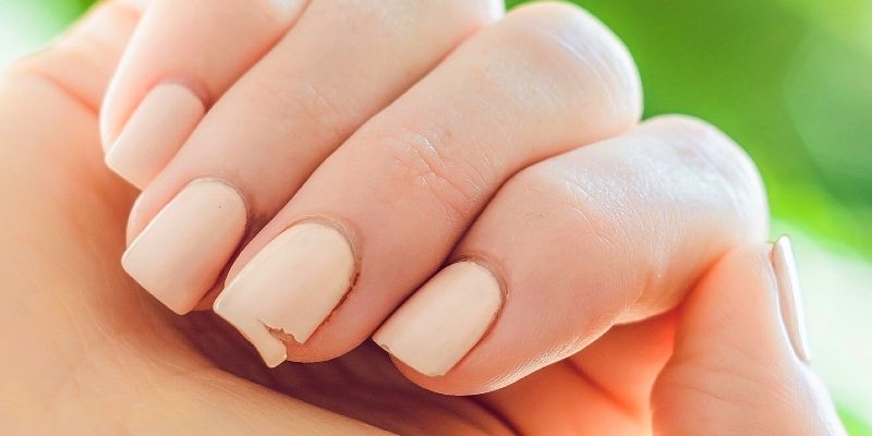 Nail Repair (typically Included)