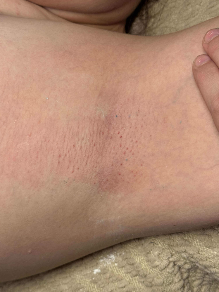 Underarm Wax at KES Esthetics in Fairmont, WV