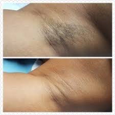 Underarm Wax