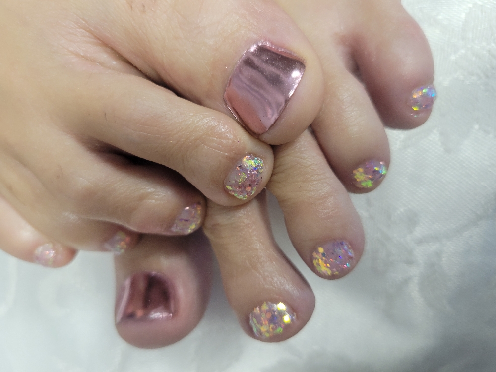*Toe Nail Repair