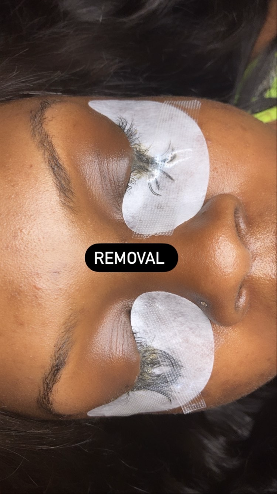 Eyelash Removal