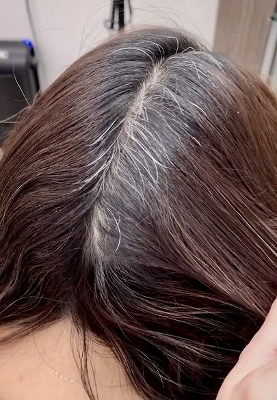 Root Touch-up