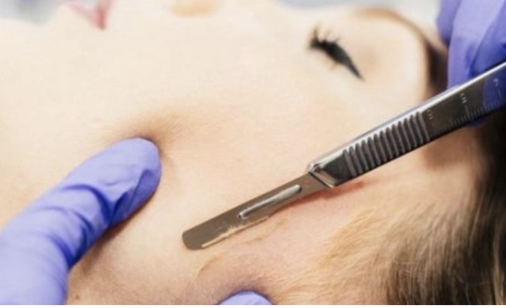 Dermaplane Only Facial