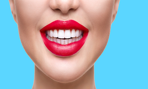 Teeth Whitening Club (12 Months)
