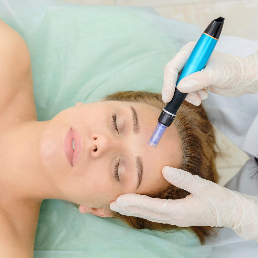 Microneedling Facial