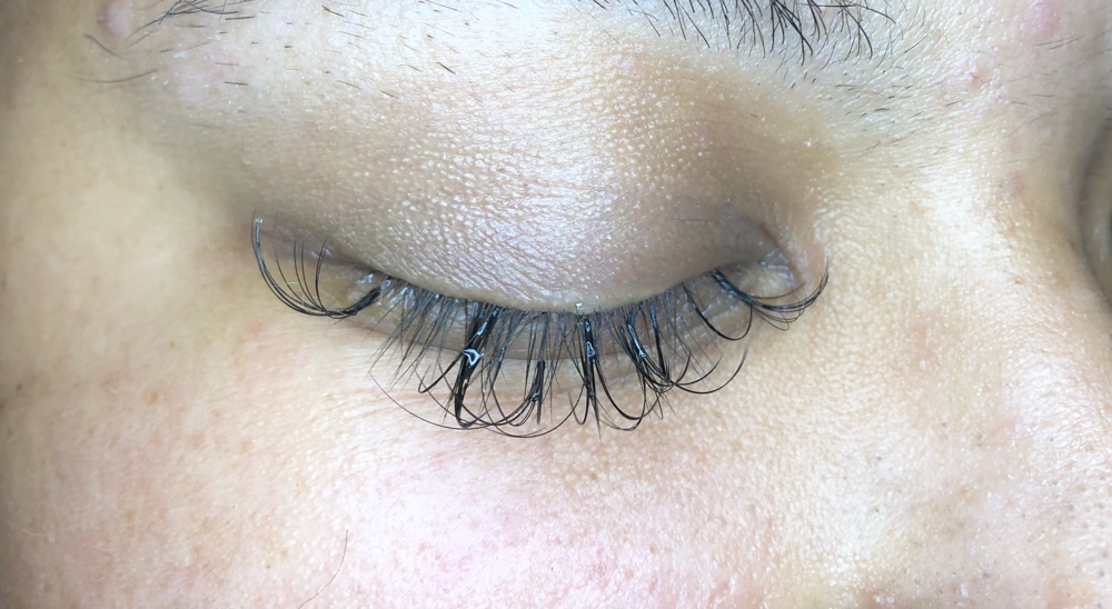 Eyelash Removal
