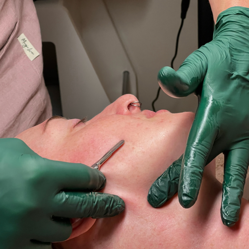 Dermaplane Express at Harmony Skin & Laser in Ashland, OR