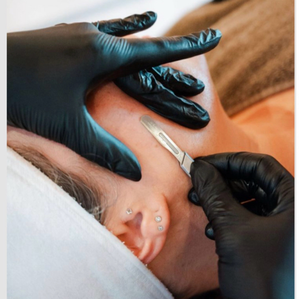 Dermaplane Express at Harmony Skin & Laser in Ashland, OR