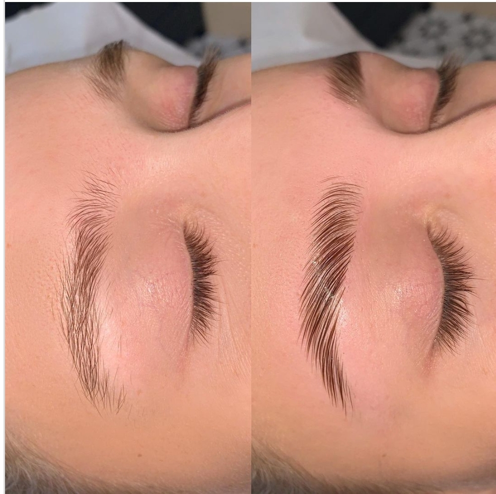 Brow Lamination