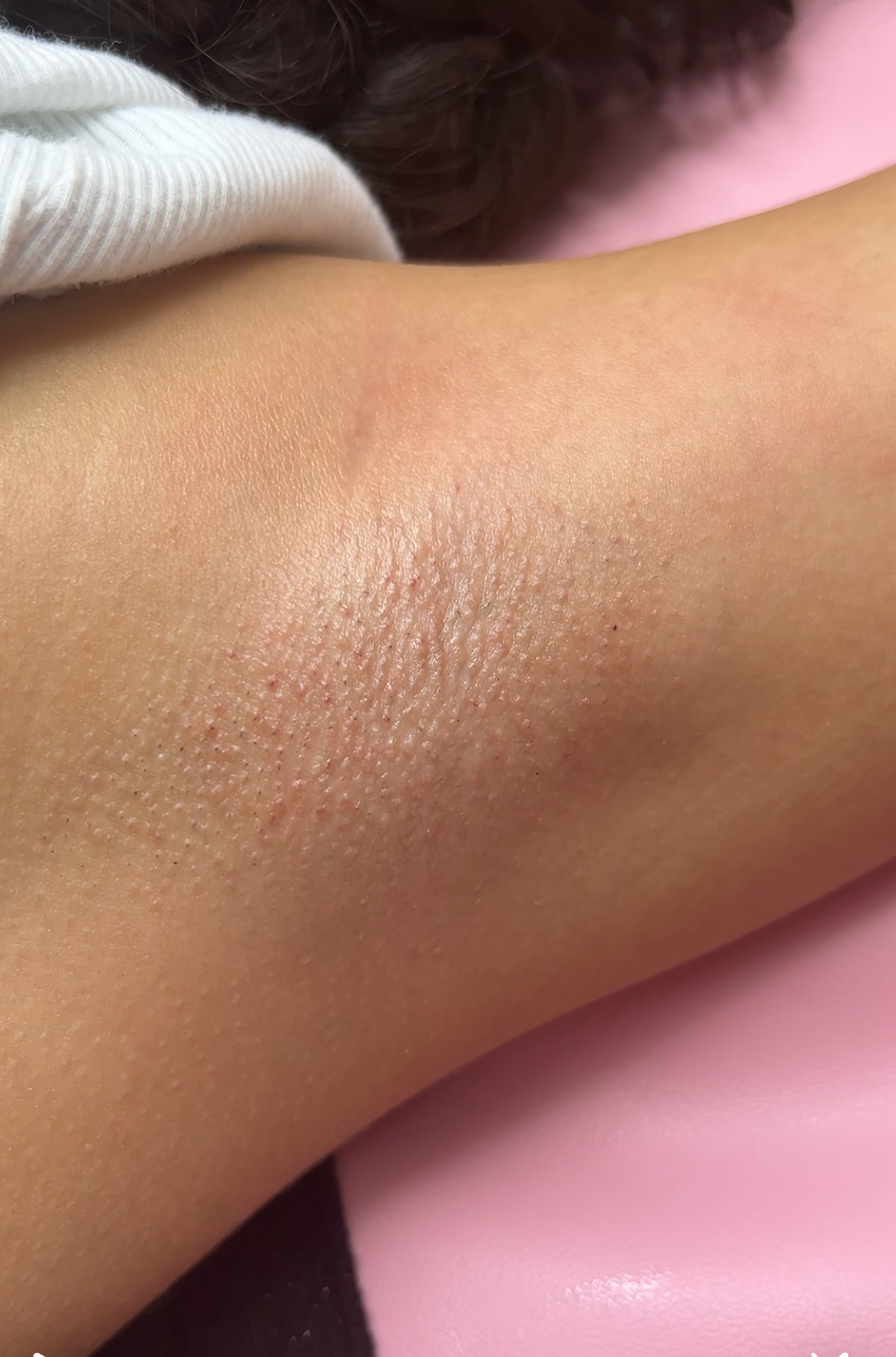 Underarm waxing
