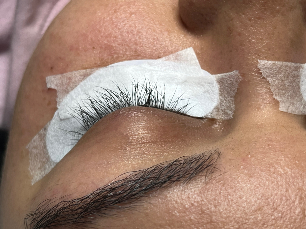 Foreign Volume Removal & Full Set