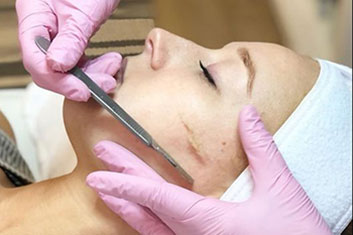 Dermaplaing